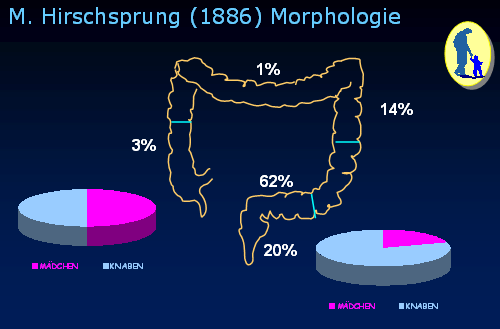 Chirurgie des Morbus Hirschsprung - 01